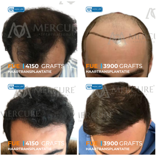 mercureistanbuloncesisonrasi (7)